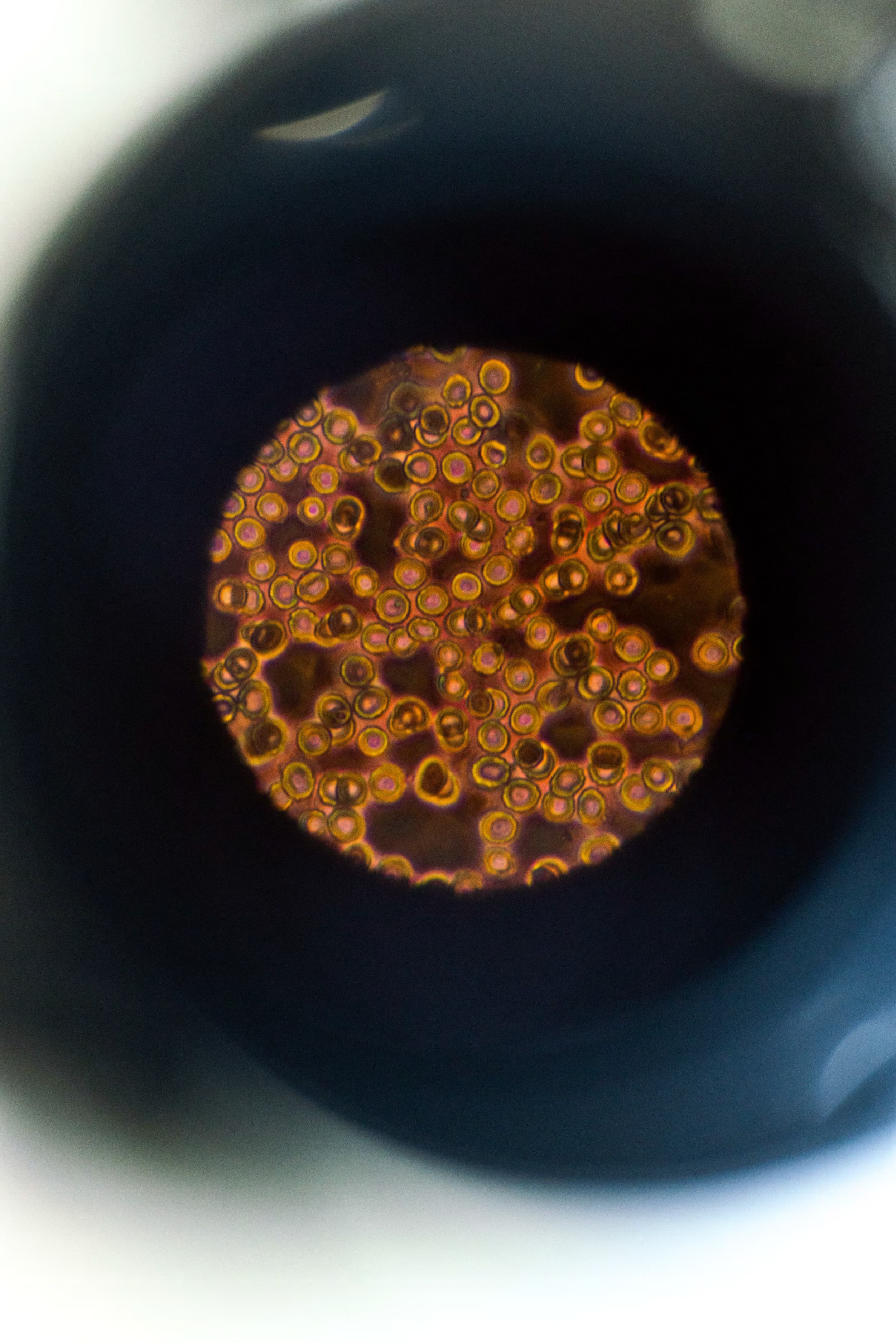 Cells viewed through a microscope eyepiece during pathogen analysis